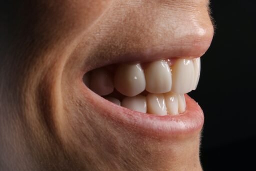 sorriso largo
